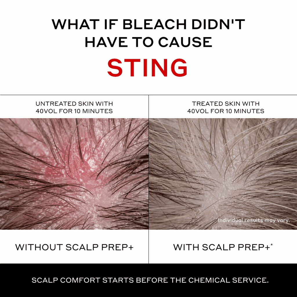 ScalpPrep+ <br>Pro Pre-Treatment