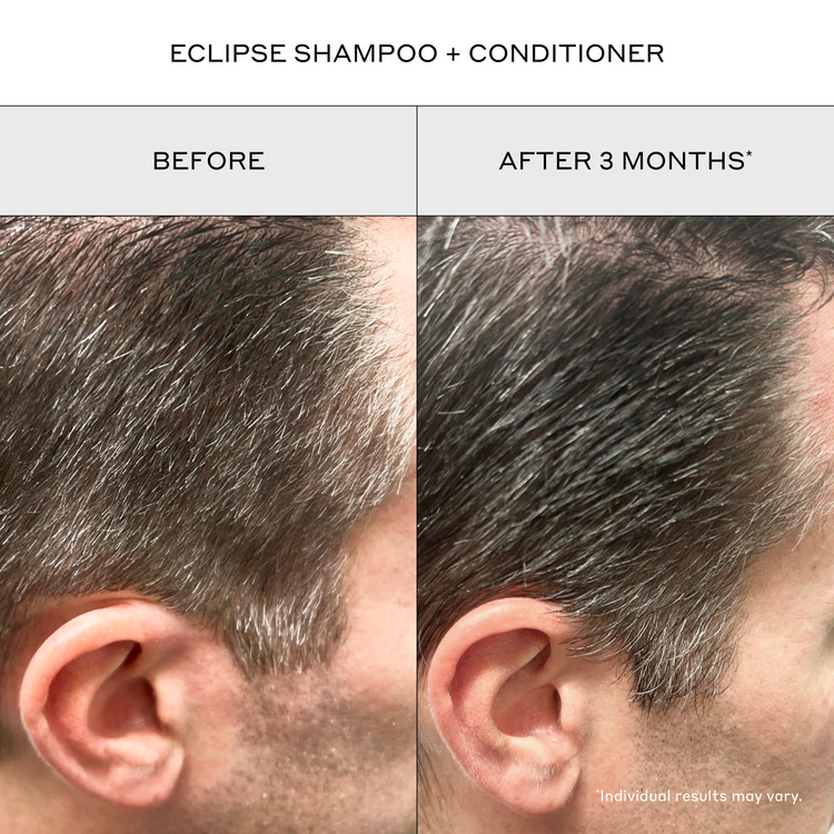 A side-by-side before and after comparison showing the back of a man's head and ear, with the left side labeled BEFORE and the right side labeled AFTER 3 MONTHS*. The top text reads 'ECLIPSE SHAMPOO + CONDITIONER'.