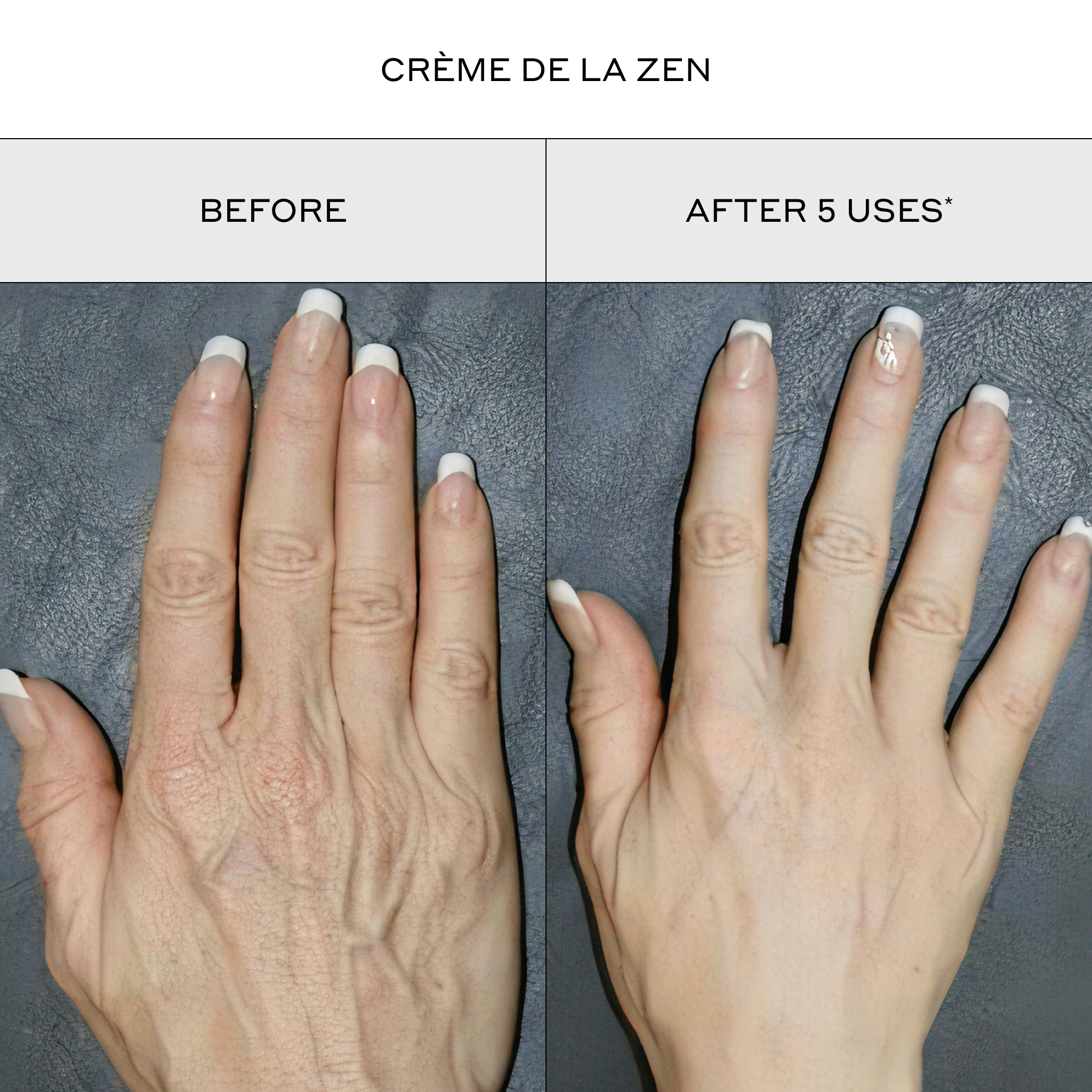 Before-and-after comparison of a hand showing the reduction of visible veins and hyperpigmentation after 5 uses of Crème de la Zen, set against a dark textured background.